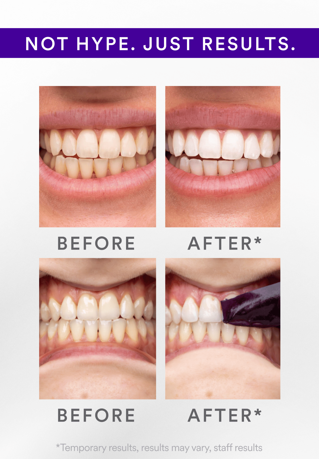 🦷Natravor™ V34 Whitening Strips| Instant whitening⭐