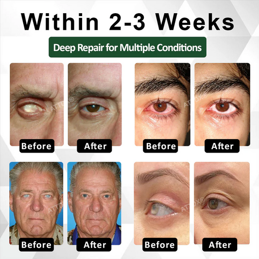 Natravor® NanoCore Eye Clear Drops Serum