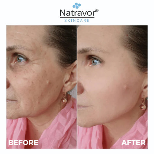 Natravor® Freeze-Dried Anti-Wrinkle Nano-Silk Collagen Sphere