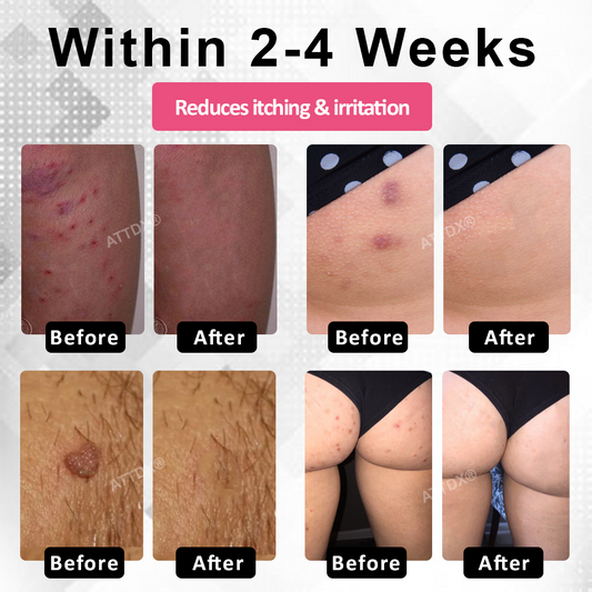 Natravor® EndoBalance Woman's Genital HPV Healing Cream