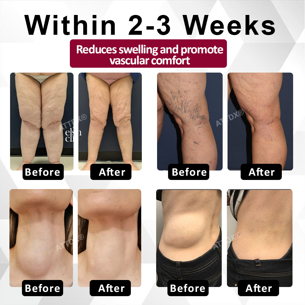 Natravor® CircuBeet Edema Health Gummies