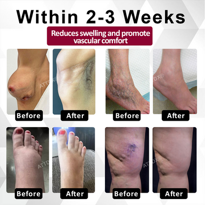 Natravor® CircuBeet Edema Health Gummies