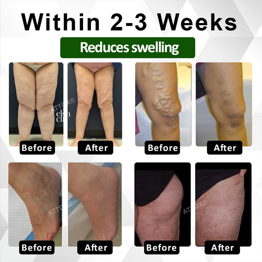 Natravor® PRO DrainEase Licorice Edema Massage Serum