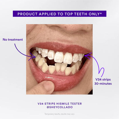 🦷Natravor™  V34 Whitening Strips｜ Instant whitening⭐