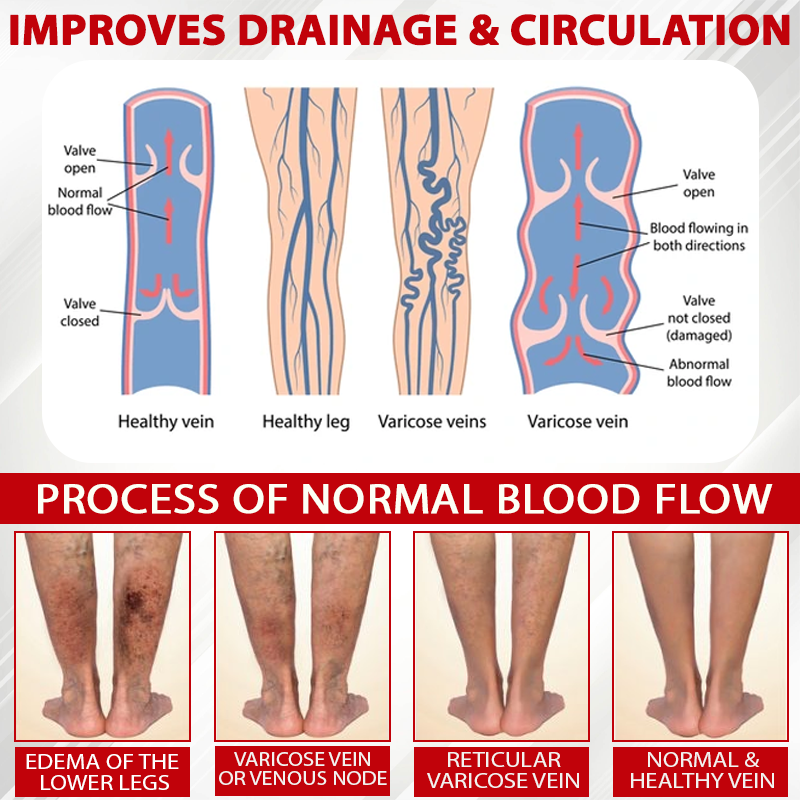 Natravor® CircuBeet Edema Health Gummies